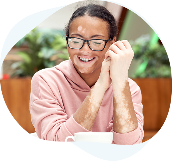 Best Vitiligo Treatment Clinic - Vitiligo Treatment in Hyderabad